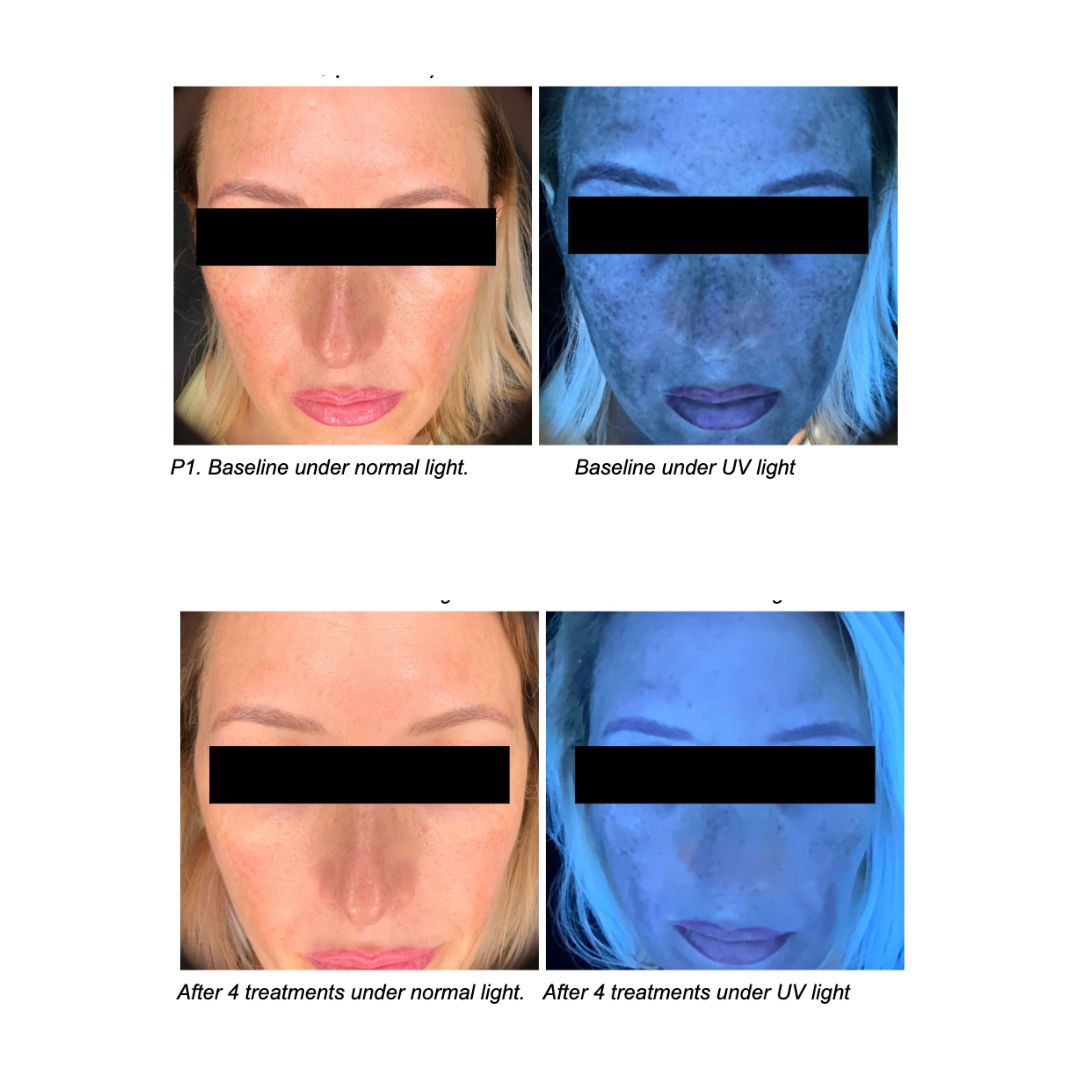 Phytotide CRF Cellular Renewal Factor 5 Ampoules
