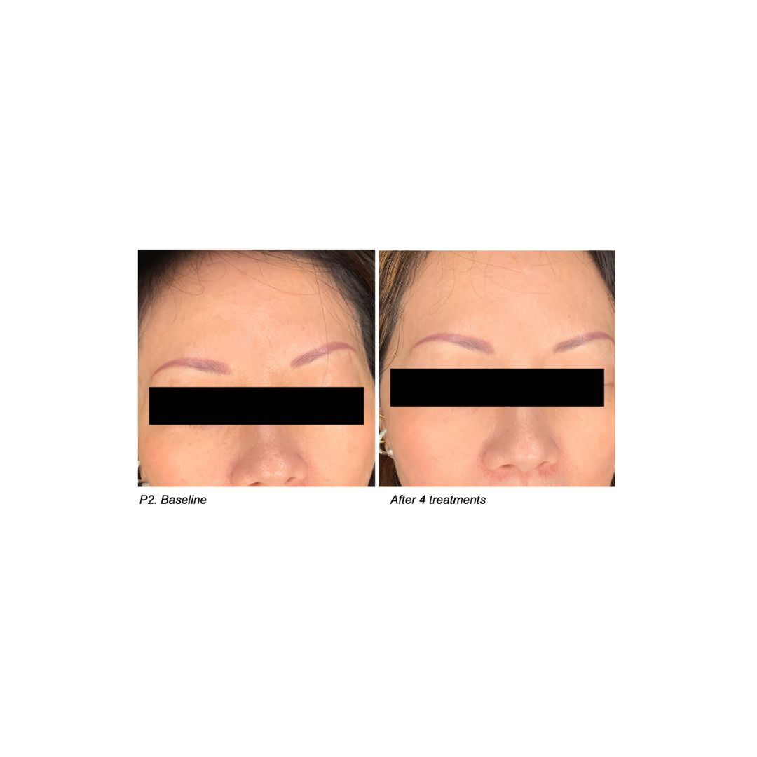 Phytotide CRF Cellular Renewal Factor 5 Ampoules