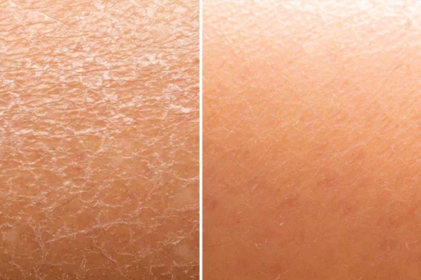 ACTIVITA® Vital Cream - No Face Skincare