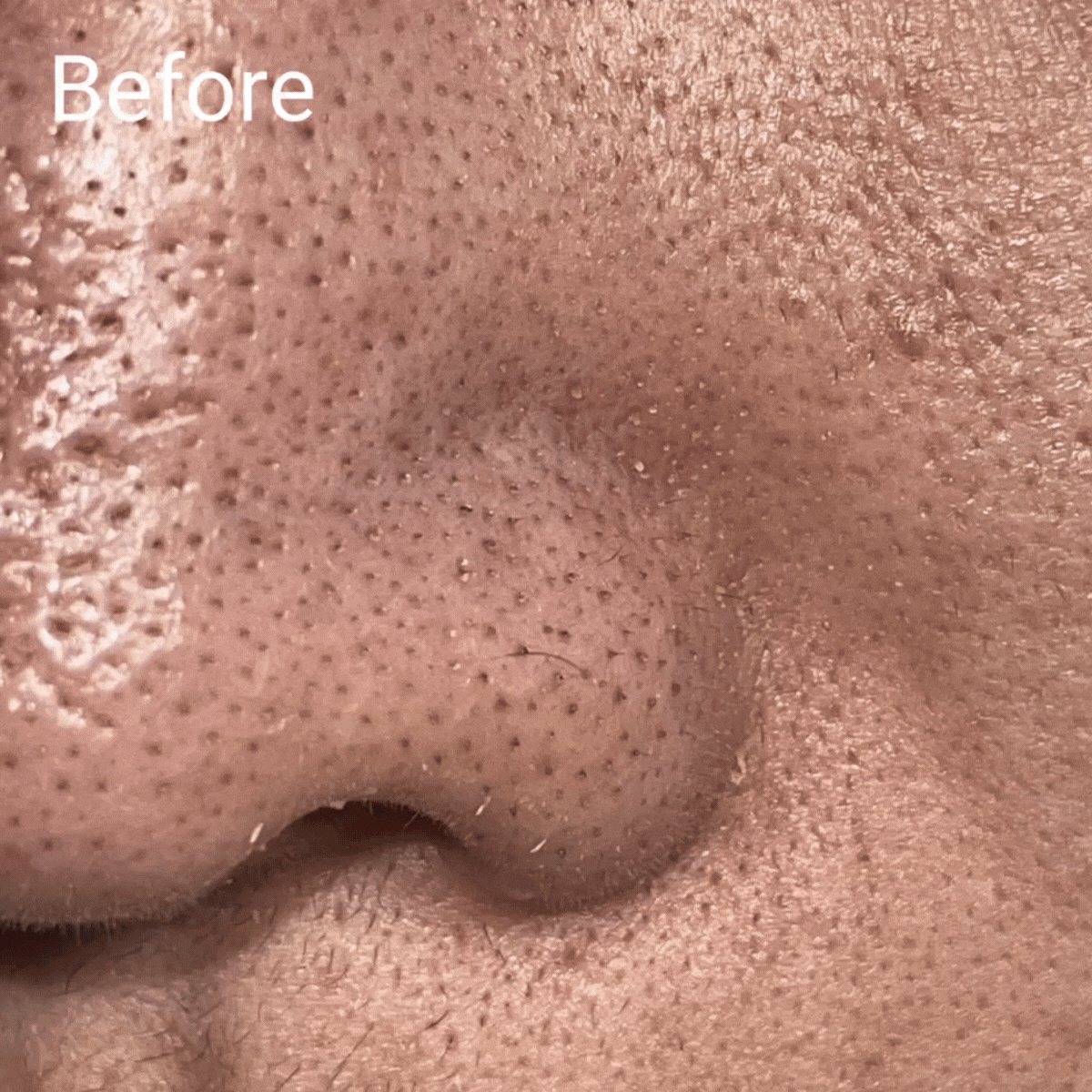 Clarifier High Definition Hydro Exfoliator - No Face Skincare